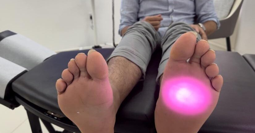 Laser Treatment