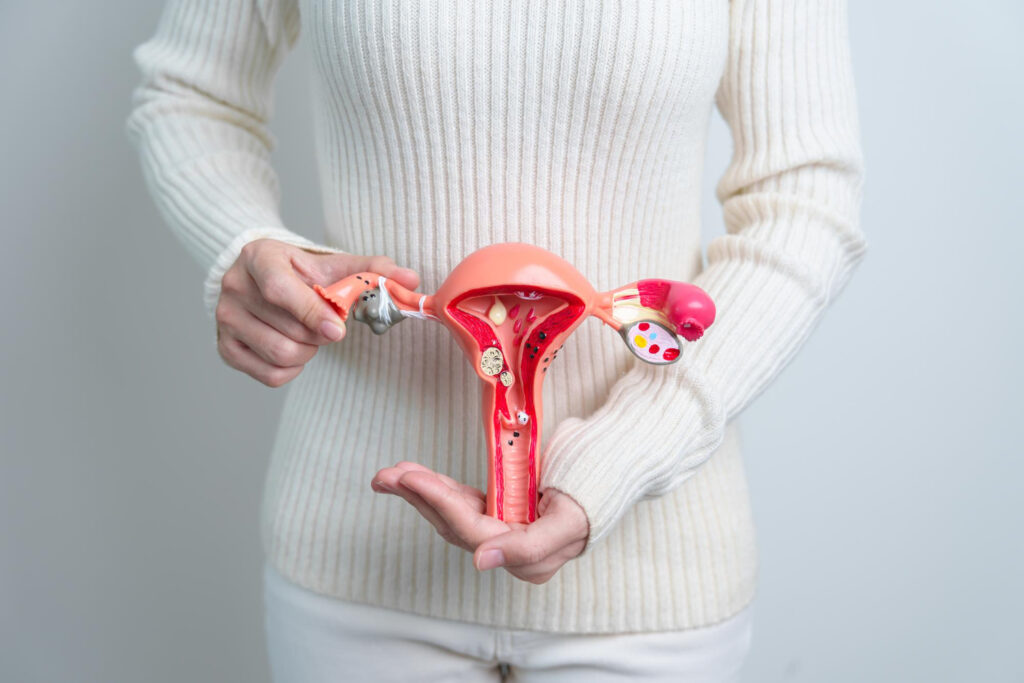 Woman holding Uterus and Ovaries model Ovarian and Cervica